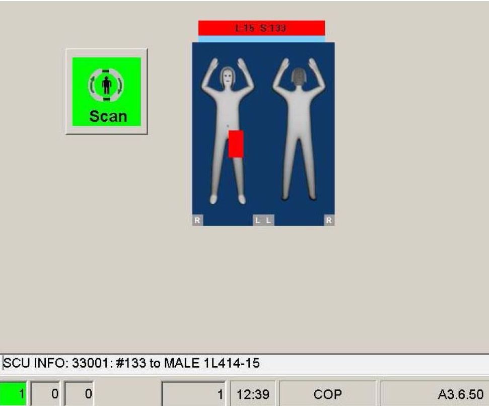 L'image du scanner schématique