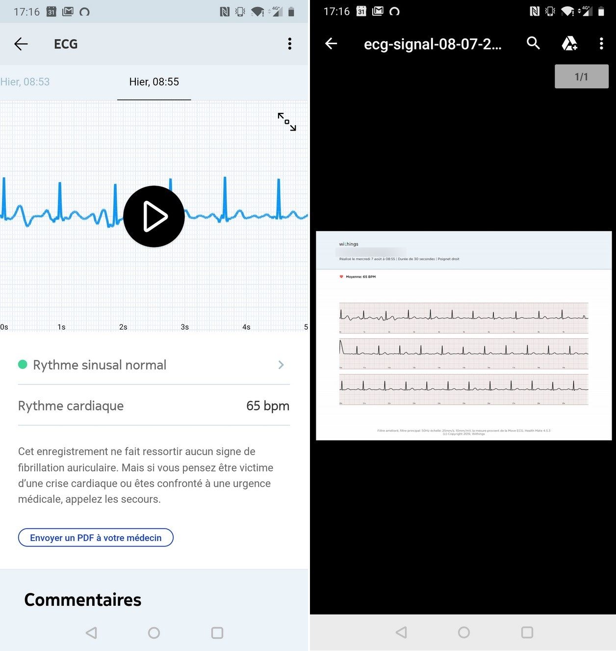 Les résultats obtenus sur l'application Withings.