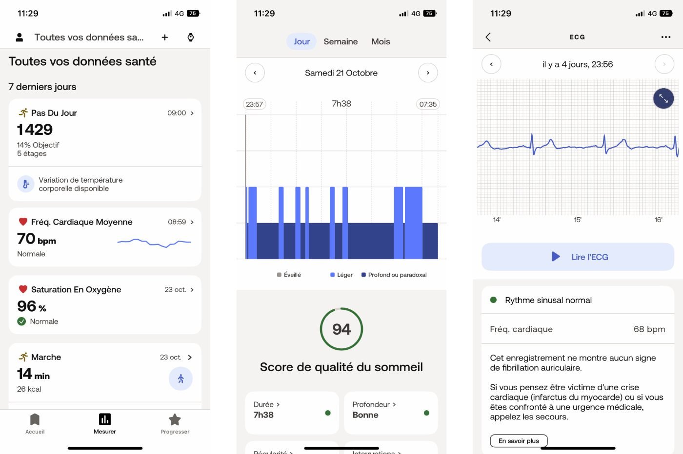 Withings App Scanwatch 2