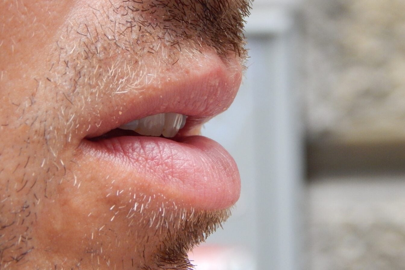 Bouche ouverte