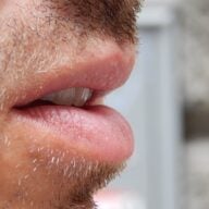Bouche ouverte