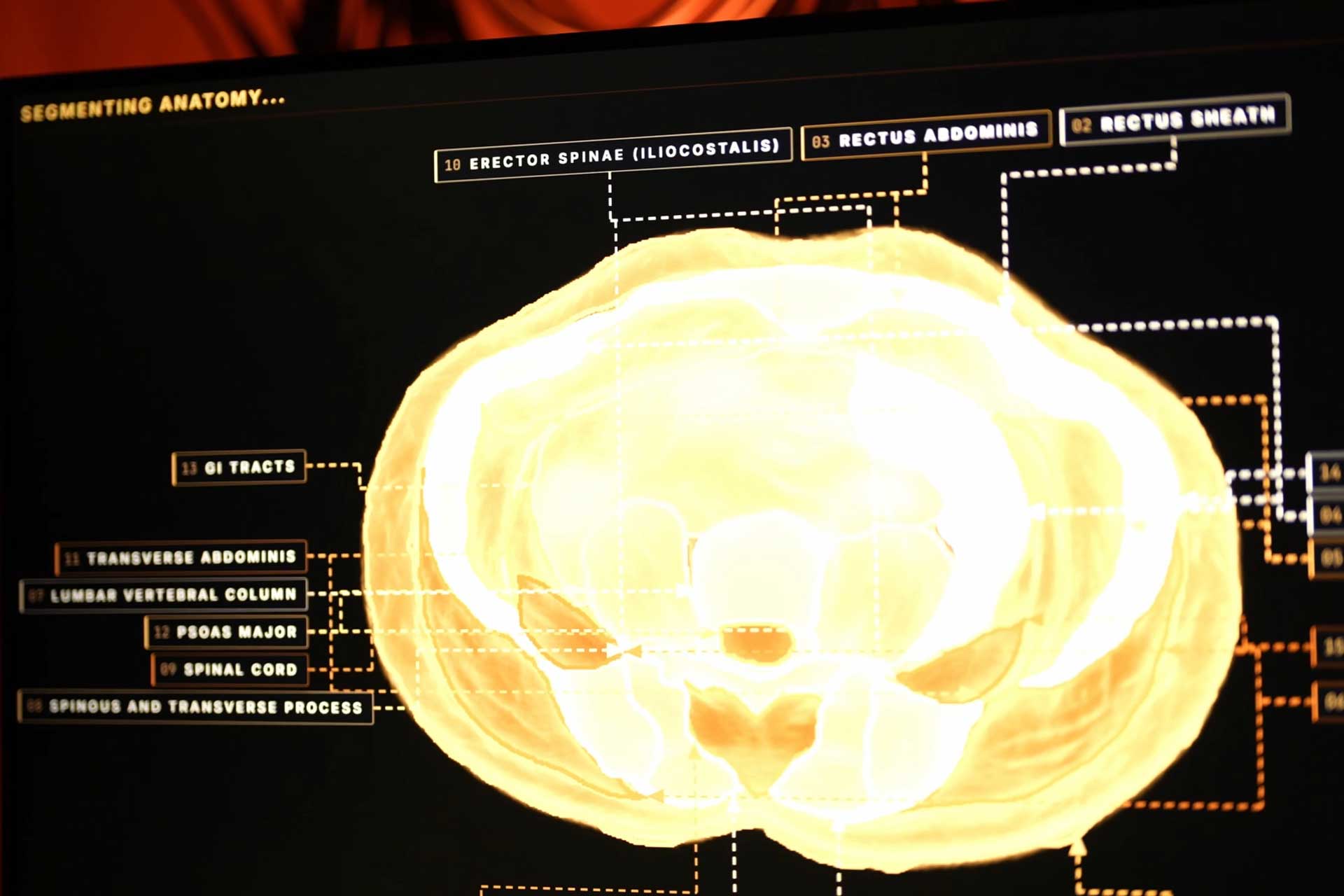 Midjourney Medical Scanner 2