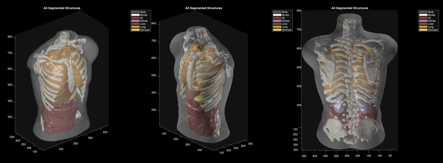 Ultrasound Phantom Segmentation