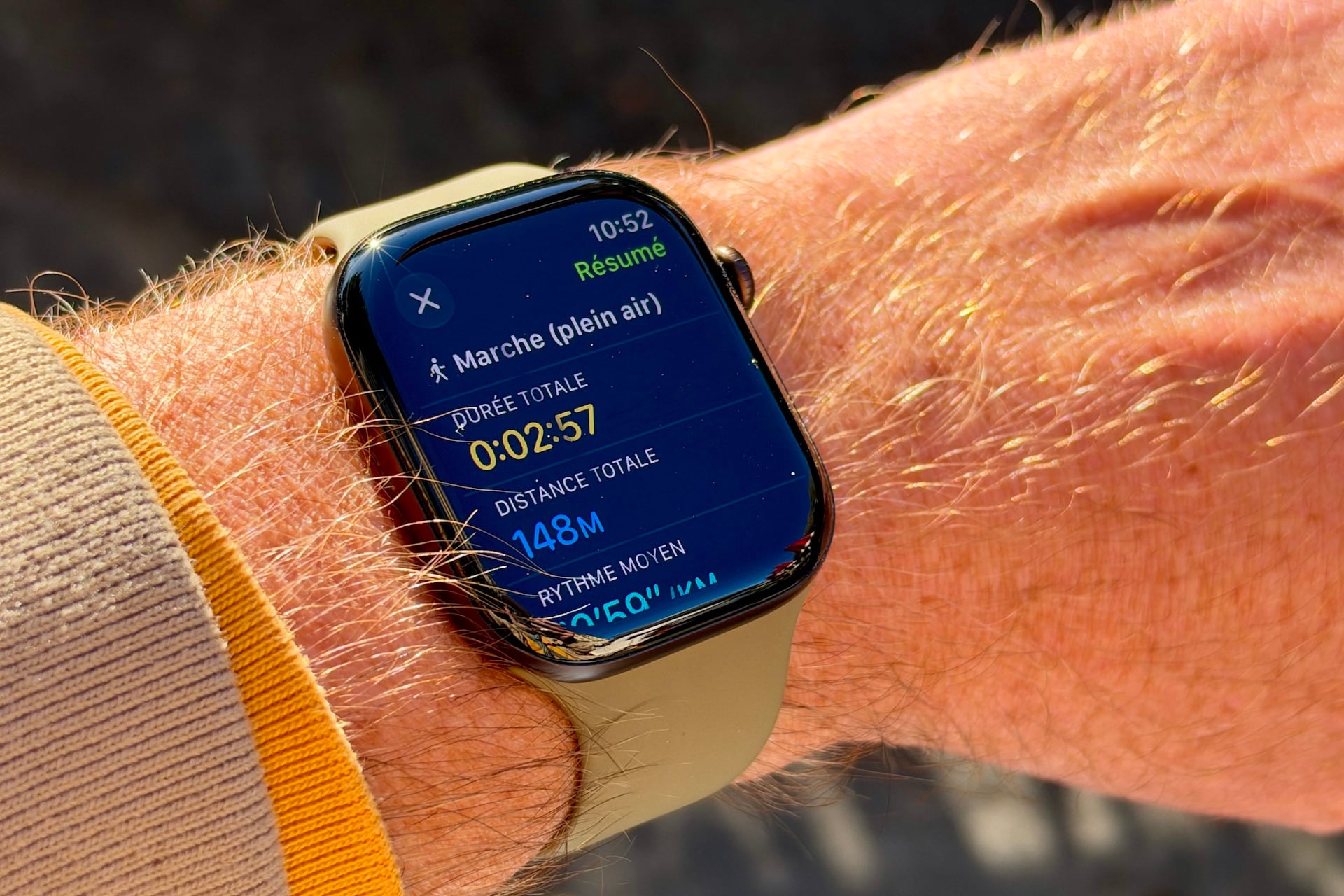 Apple Watch Series 12 00013